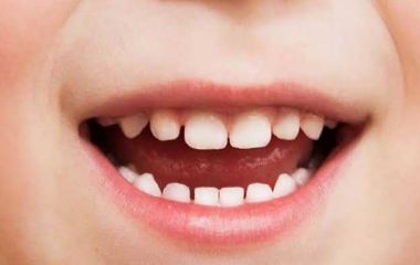 Почему молочные зубы требуют такой же защиты, как и постоянные